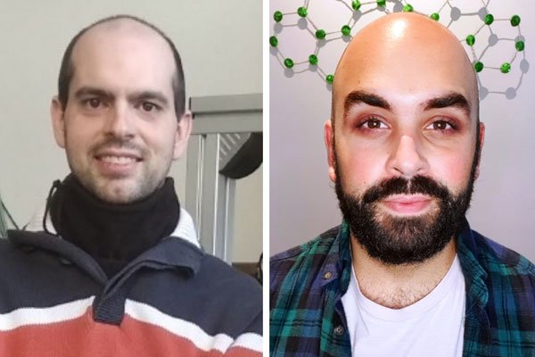 Two Phd students from the University of Zaragoza, awarded prizes for the best doctoral theses by the Spanish Microscopy Society (SME)
